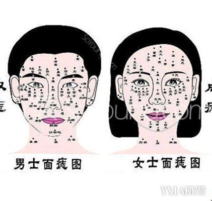 如何消痣|3种方法来快速去痣